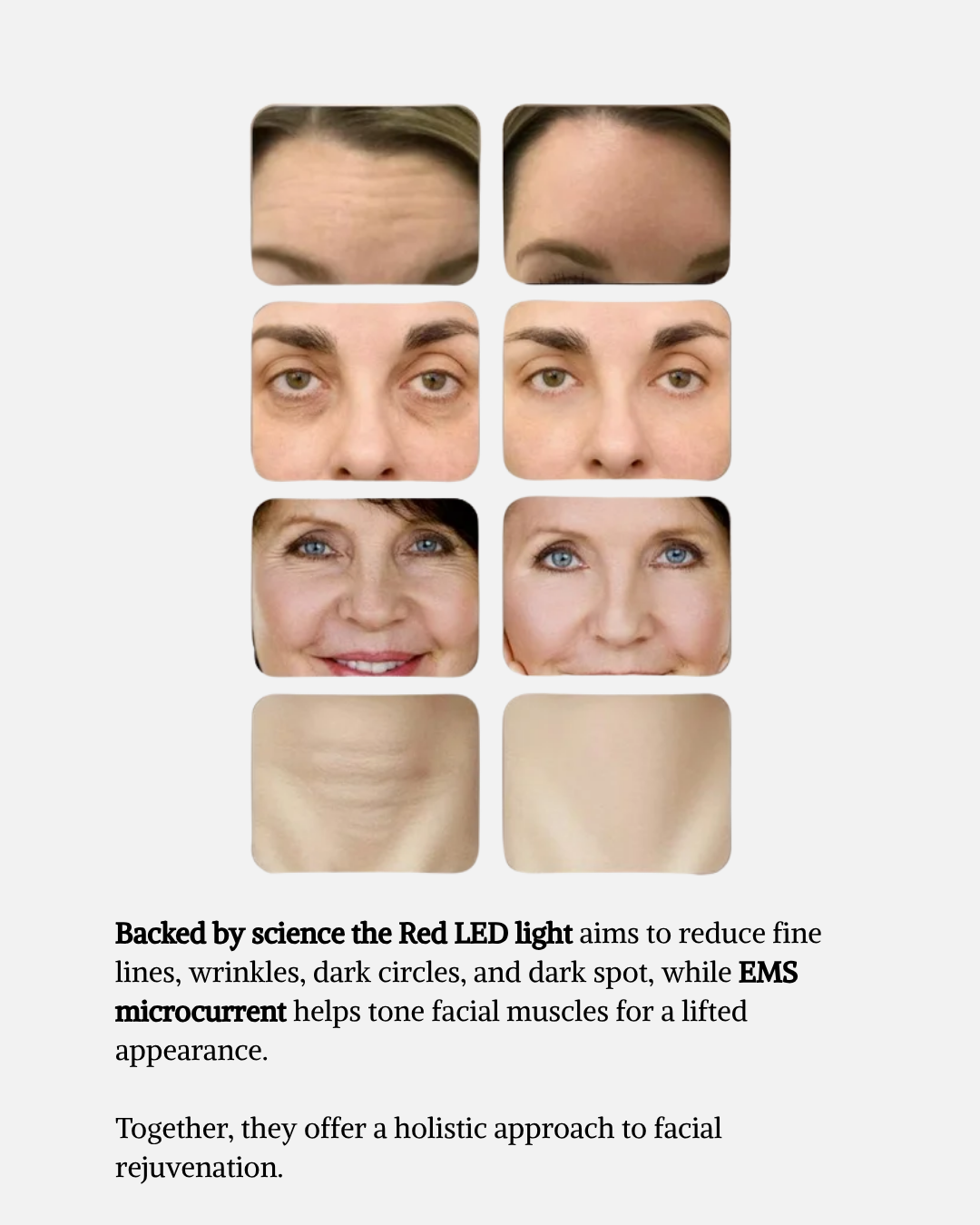 LuxiLift™ Facial Wand